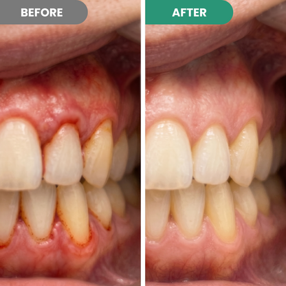 🦷Teeth Repair Pen